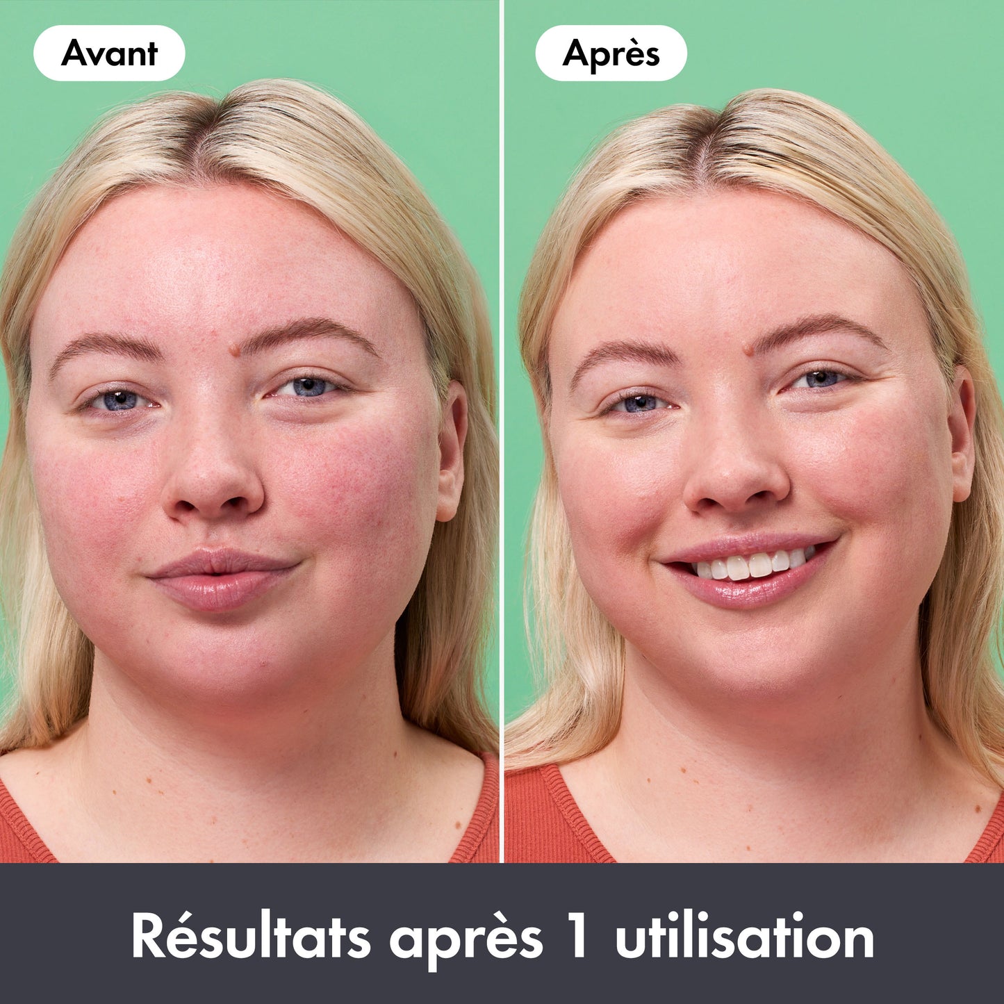 Baume Correcteur Anti-Rougeurs