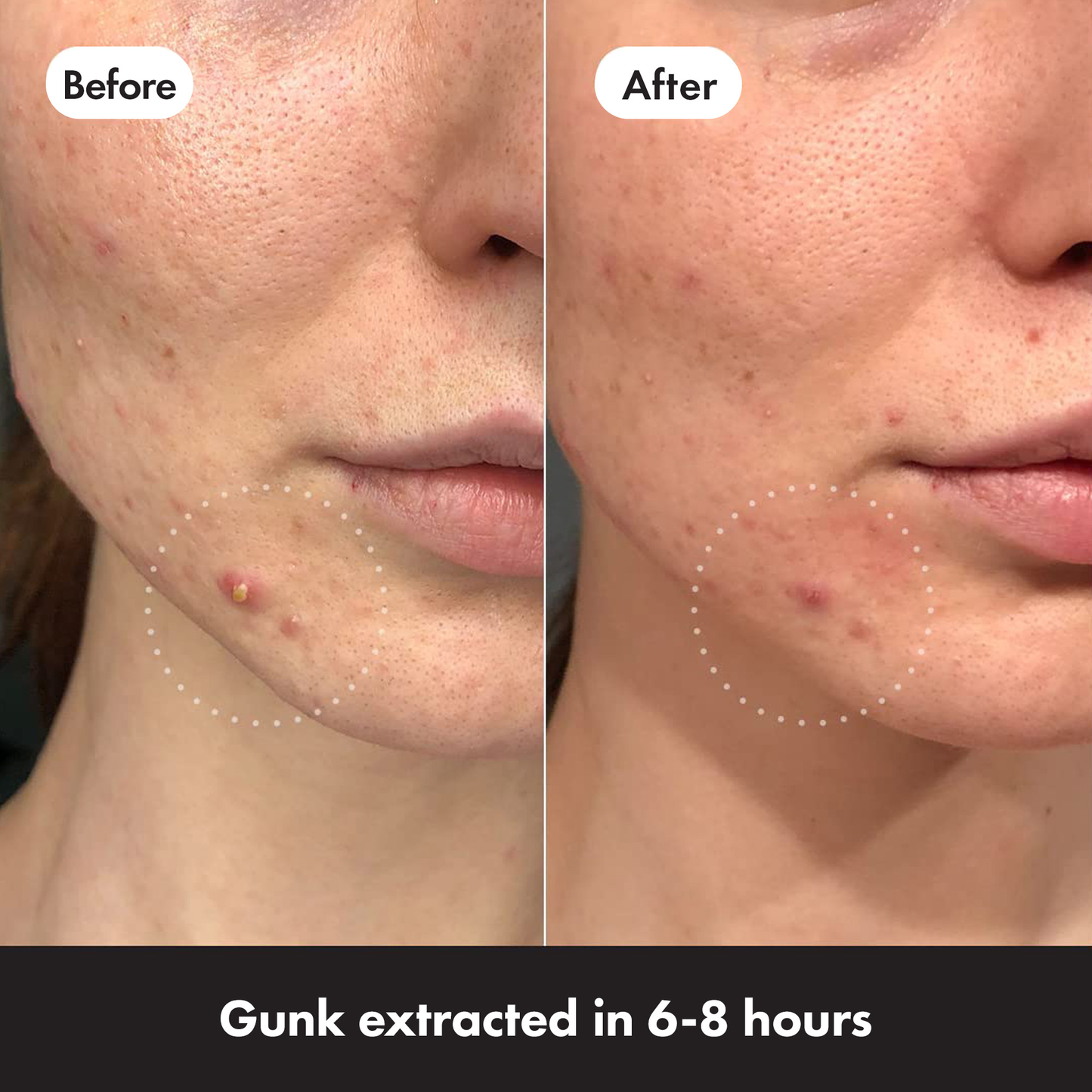 MIGHTY PATCH Invisible+