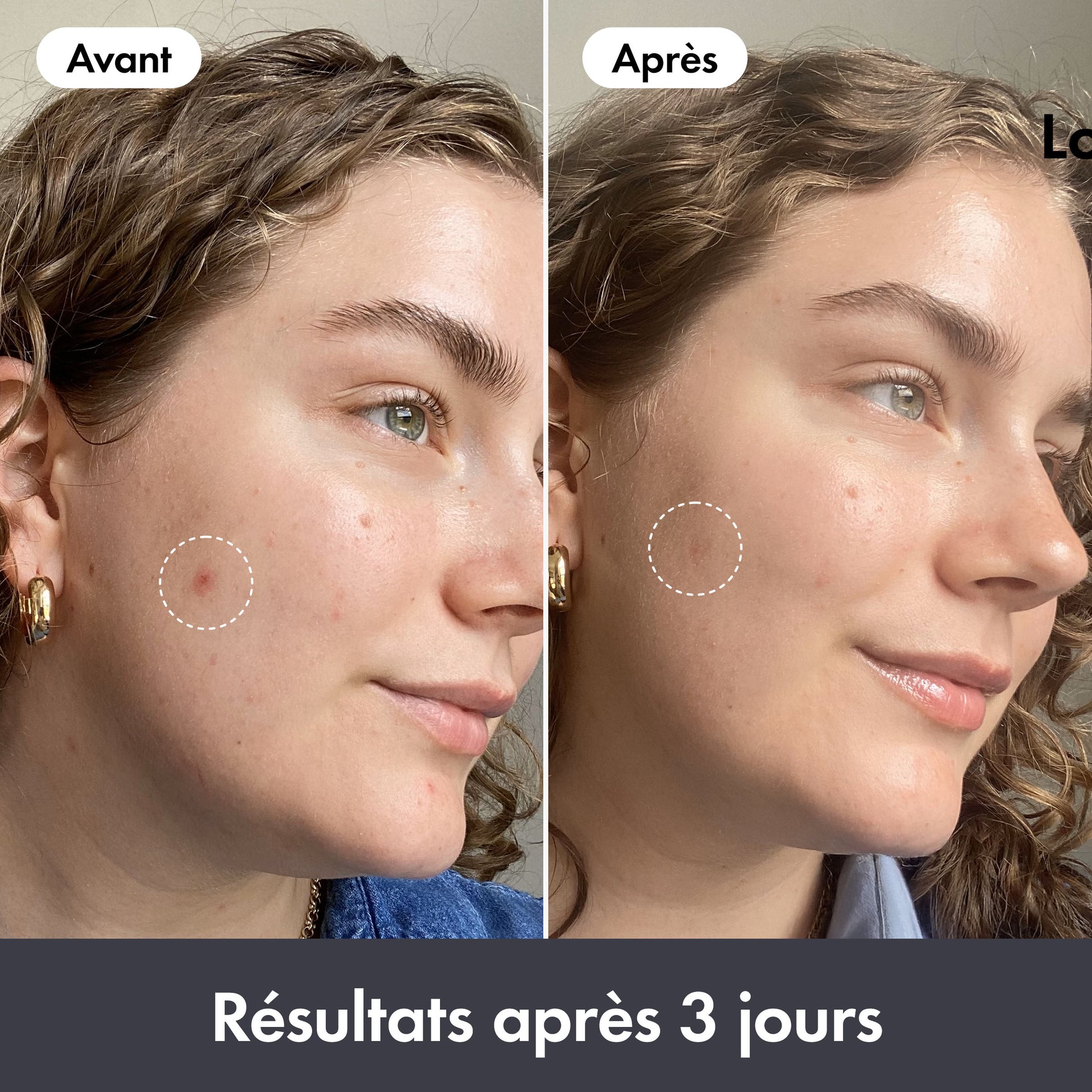 Rescue Balm Original