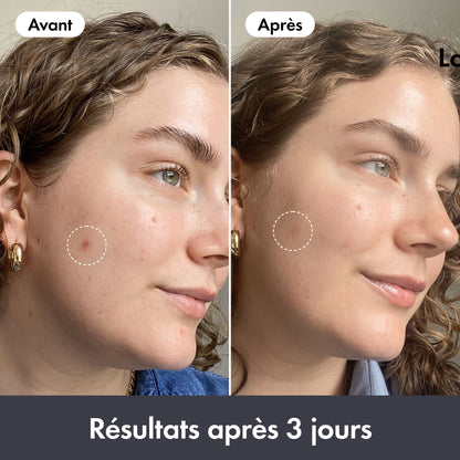 Rescue Balm Original