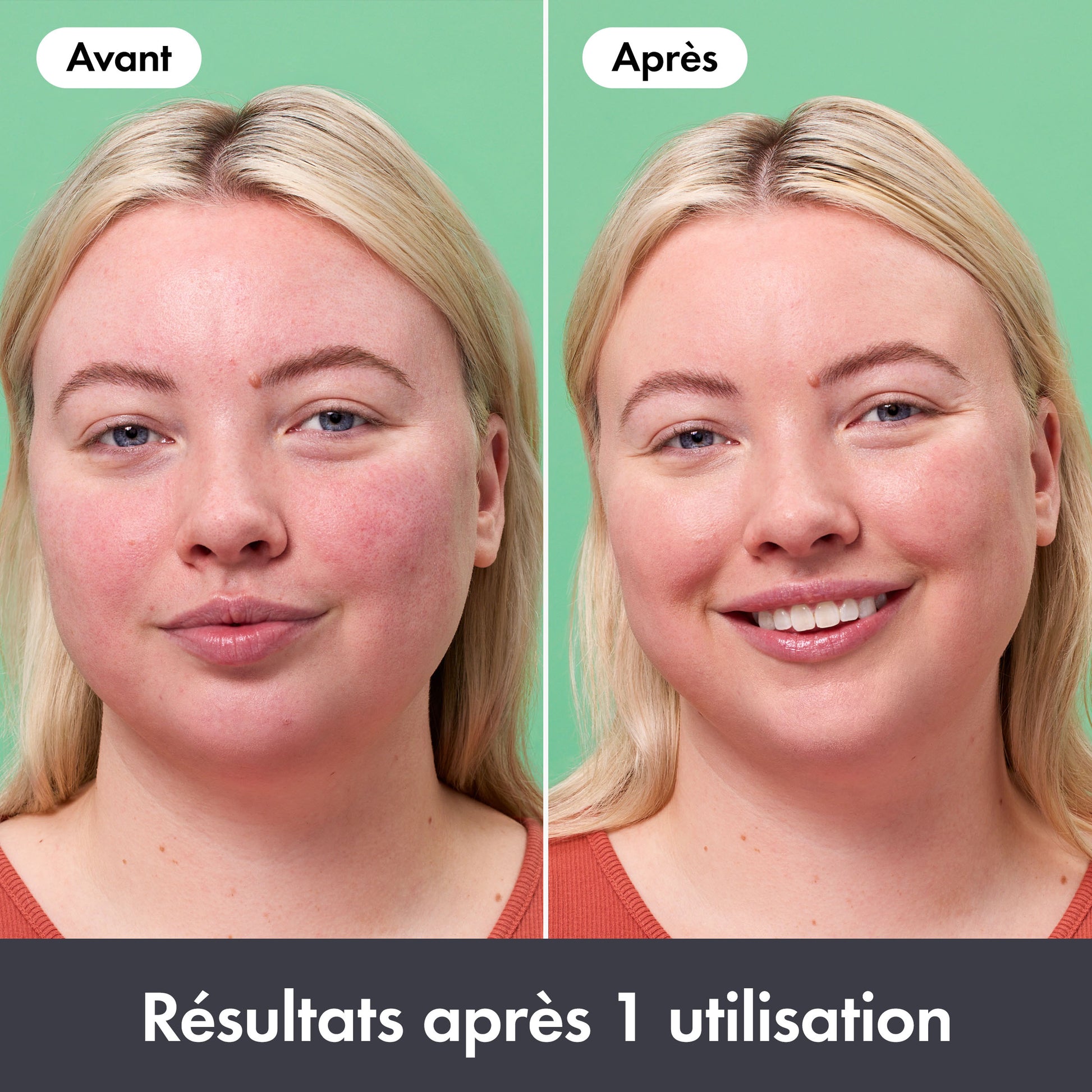 Baume Correcteur Anti-Rougeurs